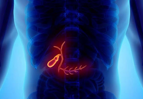 Chế độ ăn uống sinh hoạt để hạn chế các rối loạn sau khi cắt túi mật